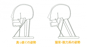 日頃の姿勢による“あごの形”の変化