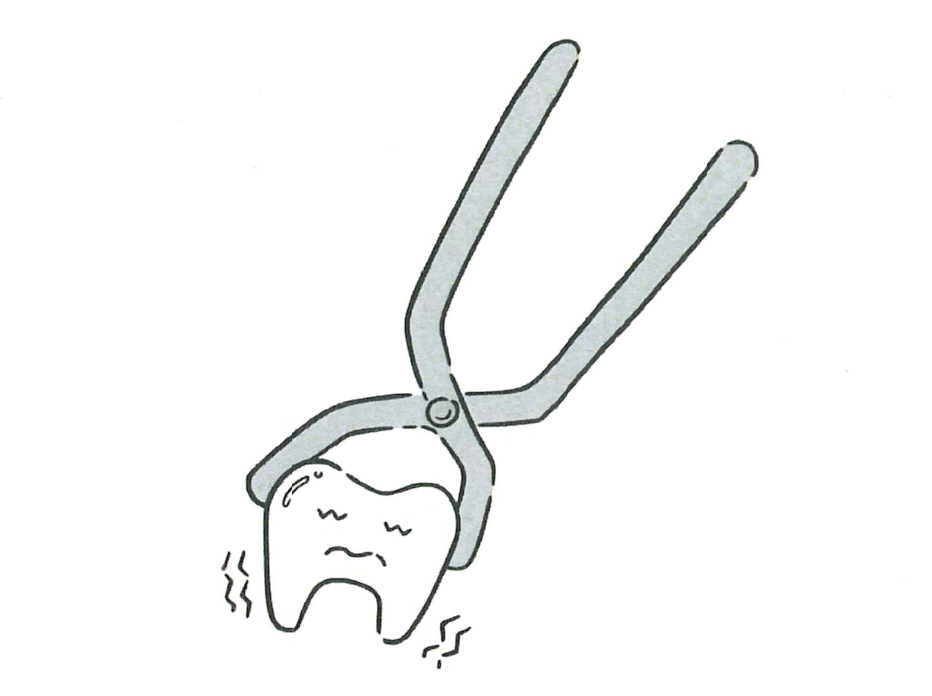 歯を「抜かれる」ことの原因は？